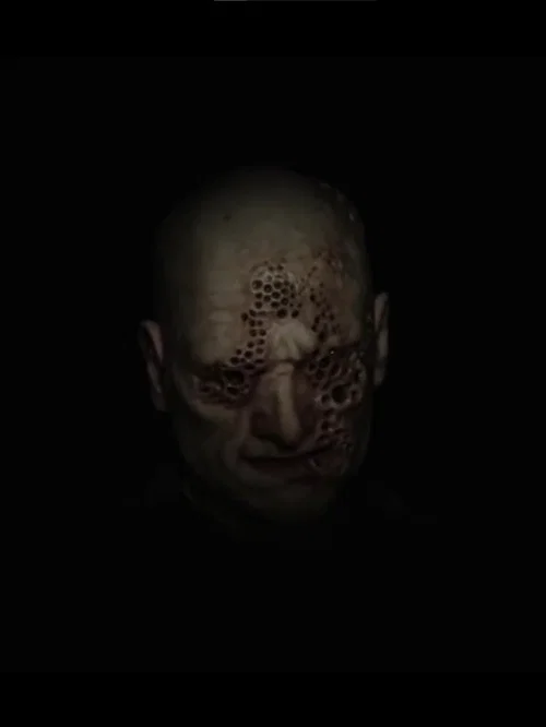 Trypophobia